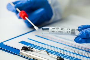 teste RT PCR shutterstock 1704297991 Sheraton São Paulo passa a realizar exames para COVID-19